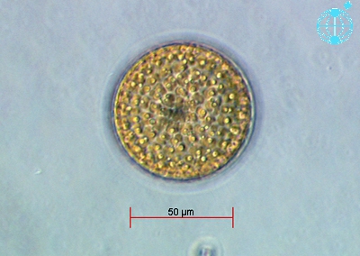 Thalassiosira punctigera Thalassiosira punctigera