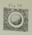 Calcisphaera laevis Williamson, 1880 Calcisphaera laevis Williamson, 1880