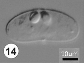 Ceratomyxa honckenii sp. n. from Amblyrhynchotes honckenii