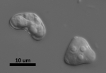 Ceratonova shasta spores