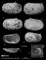 Cythere acanthoderma Brady, 1880 - Lectotype and Paralectotypes