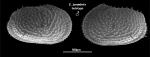 Male holotype of Echinocythereis jorunbrix Brandão & Karanovic, 2015 from original description