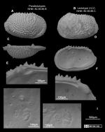 Echinocythereis irpex (Brady, 1880) - LECTOTYPE AND PARALECTOTYPES