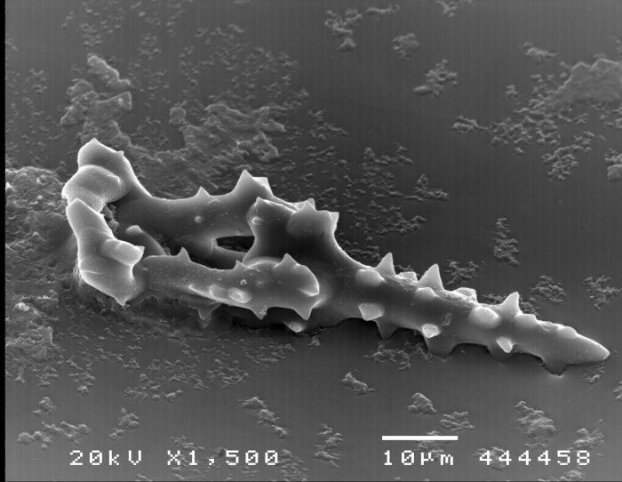 Pearsonothuria graeffei (SEM, spicules) Pearsonothuria graeffei (SEM, spicules)