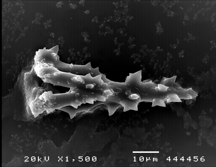 Pearsonothuria graeffei (SEM, spicules)