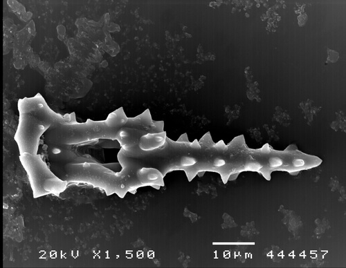 Pearsonothuria graeffei (SEM, spicules)