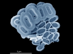 Syracosphaera azureaplaneta