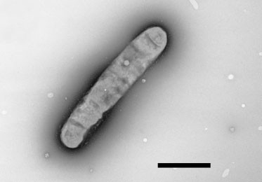 Nitratifractor salsuginis Nitratifractor salsuginis