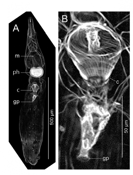 Freddius tricaudatus gen. et sp. nov. Images obtained from confocal laser scanning microscopy, ICHUM 4833 (paratype).