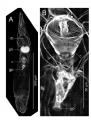 Freddius tricaudatus gen. et sp. nov. Images obtained from confocal laser scanning microscopy, ICHUM 4833 (paratype).
