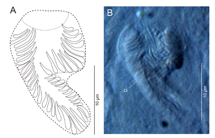 Freddius tricaudatus gen. et sp. nov., cirrus spine, ICHUM 4832 (holotype).