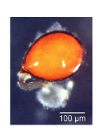 Proschizorhynchella shibazakii sp. nov. Photograph of an egg taken in life, ICHUM 4861 (paratype)