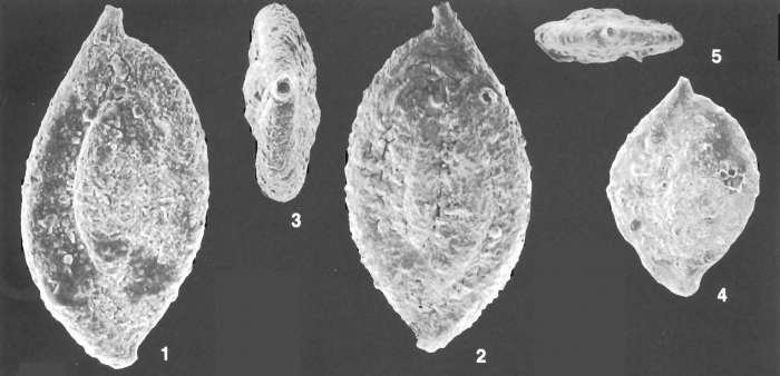 Ammomassilina alveoliniformis (Millett) identified specimen