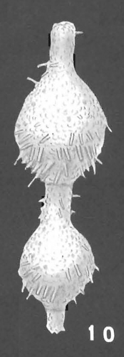 Loeblichopsis spiculifera Hofker identified specimen