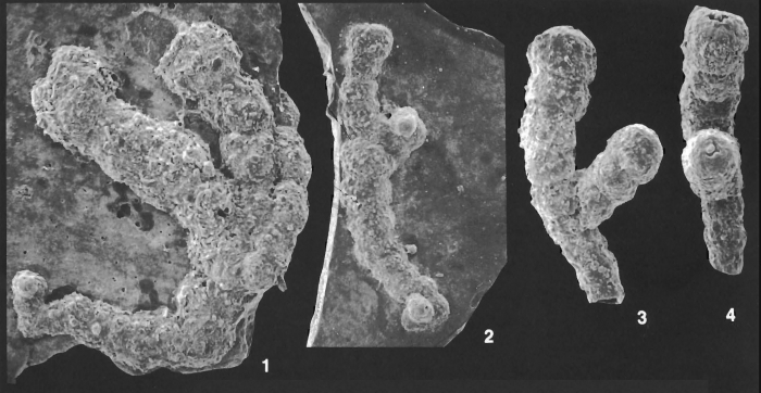 Placopsilina bifurca Loeblich and Tappan Holotype and Paratypes