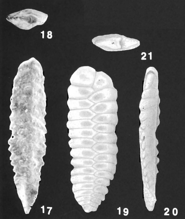 Plotnikovina timorea Loeblich & Tappan paratypes Plotnikovina timorea Loeblich & Tappan paratypes