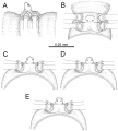 Myriapoda (myriapods)