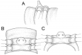 Myriapoda (myriapods)