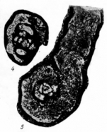 Lituotubella glomospiroides Rauzer-Chernousova, 1948