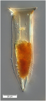 Odontophorella serrulata from a mesopelagic sample.