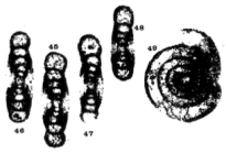 Ammarchaediscus (Ammarchaediscus) bozorgniae Conil & Pirlet, 1974