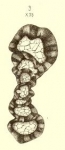 Spirillina subangulata Möller, 1879