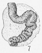 Calcivertella adherens Cushman & Waters, 1928 Calcivertella adherens Cushman & Waters, 1928