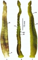 Hirudinea (leeches)