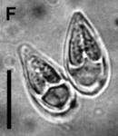 Myxobolus pangasii myxospore