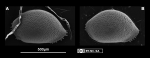 Ostracoda (seed shrimp)