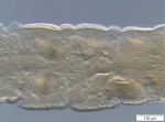 Stylodrilus sanguineus (genital area)