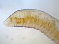 Oligochaeta (oligochaetes)