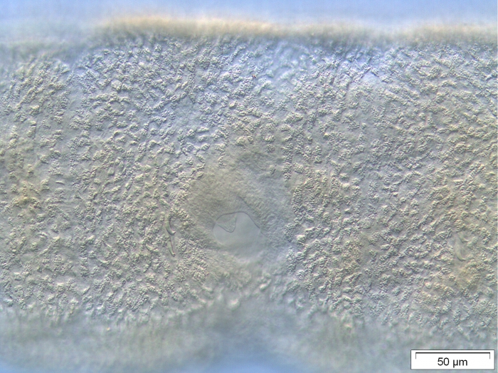 Stylodrilus brachystylus (penis) Stylodrilus brachystylus (penis)