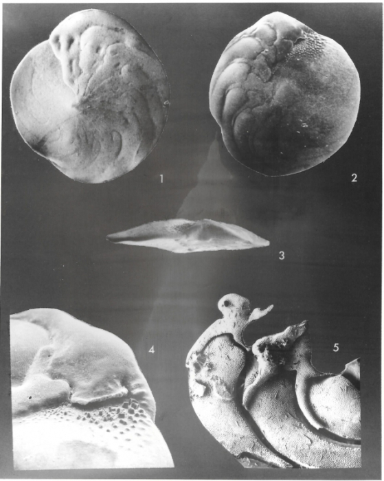 Amphistegina bicirculata Larsen, 1976 