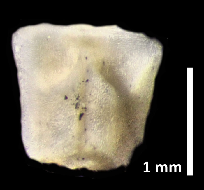 Rhizocrinus conifer AH Clark, 1909, holotype USNM 2279