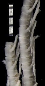 Daidalometra eurymedon AH Clark, 1950, holotype USNM E8991