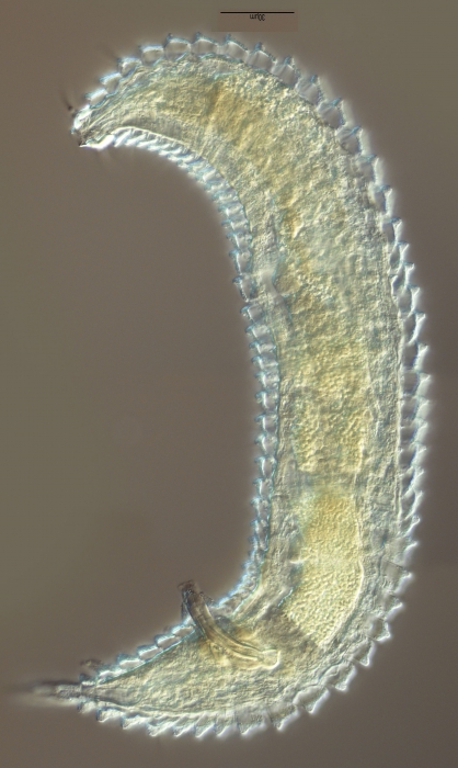 Tricoma (Quadricoma) bahamaensis (Timm, 1970)