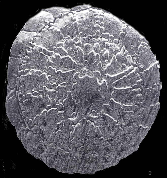 Challengerella persica Billman, Hottinger and Osterle, 1980 holotype Challengerella persica Billman, Hottinger and Osterle, 1980 holotype