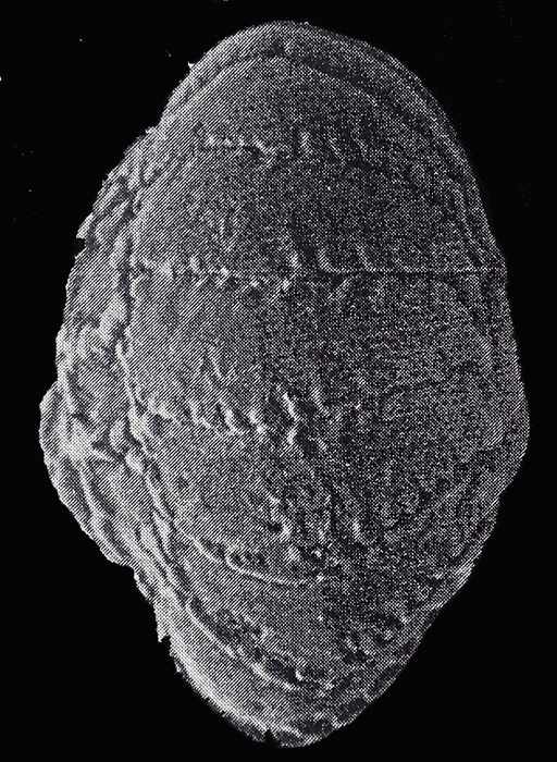 Challengerella persica Billman, Hottinger and Osterle, 1980 paratype