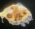 Scyphozoa (jelly fish)