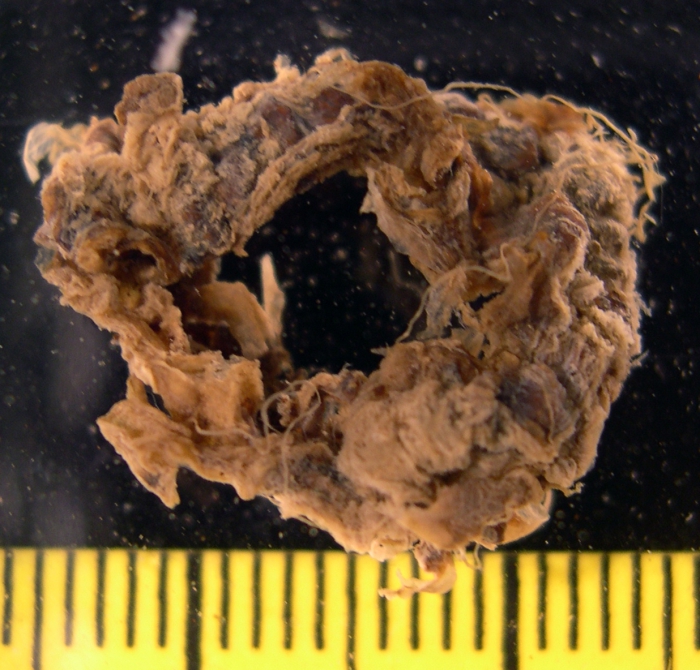 medusa, holotype medusa, holotype