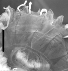 part of medusa, oral view