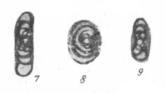Archaediscus spirillinoides Rauzer-Chernousova, 1948