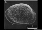 Neotype of Cythere rhomboidea Fischer, 1855 designated and illustrated by Athersuch & Whittaker, 1976