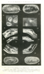 Leguminocythereis bisanensis Okubo, 1975 from Schornikov & Shaitarov, 1979, Pl.