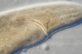 Nematoda (roundworms)