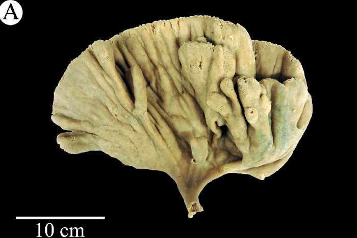 Acantorna tahoma Lehnert &amp; Stone, 2020