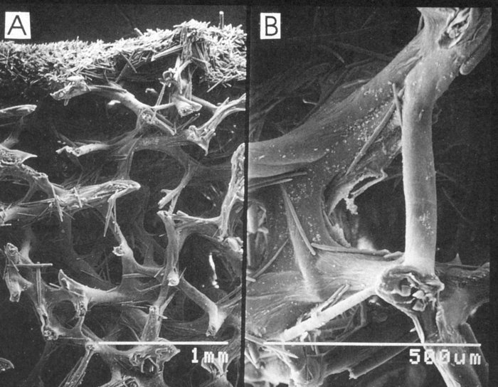 Clathria (Axosuberites) patula (Hooper, 1996)