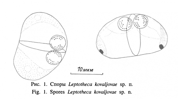 Myxospores from gall bladder of host