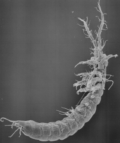 SEM of Derocheilocaris 